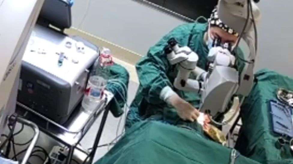 China: Outrage over doctor punching patient during surgery