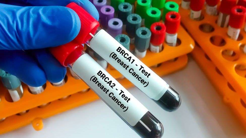 BRCA tests to be offered to Jewish people to detect cancer risk