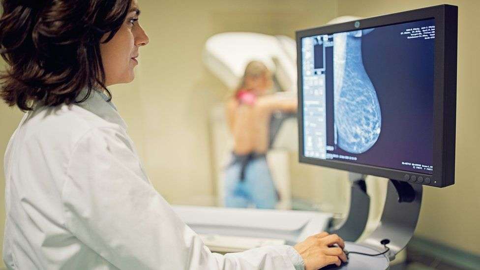 Improvement in cancer survival rates slowing down