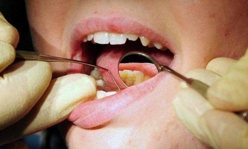 NHS dentists: Exam could be scrapped for overseas applicants