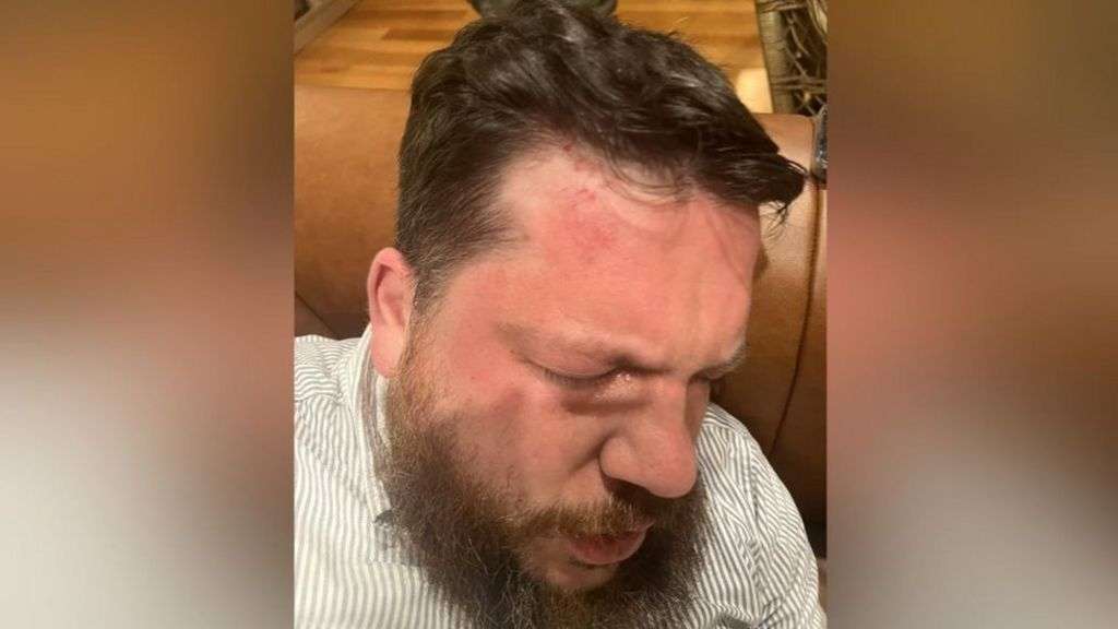 Leonid Volkov: Navalny ally blames Putin henchmen for attack in Lithuania